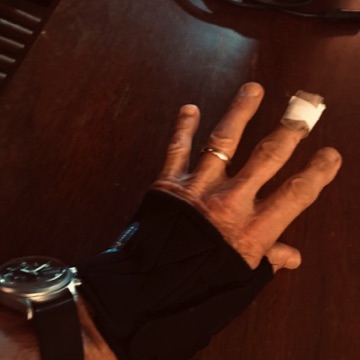 Lefty is having a rough summer but surprisingly I can still play. Mild wrist and trumb pain and more than mild finger cut pain. Should be more careful making veggie lasagna. Lefty is having a rough summer but surprisingly I can still play. Mild wrist and trumb pain and more than mild finger cut pain. Should be more careful making veggie lasagna.